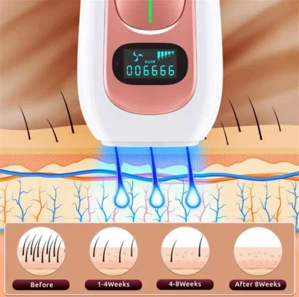 دستگاه لیزر اصلاح موهای بدن IPL Hair Removal Device PA2