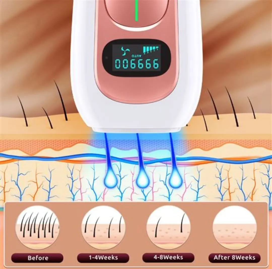 دستگاه لیزر اصلاح موهای بدن IPL Hair Removal Device PA2
