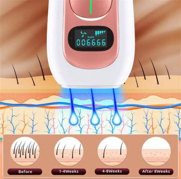 دستگاه لیزر اصلاح موهای بدن IPL Hair Removal Device PA2