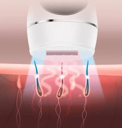 دستگاه لیزر اصلاح موهای بدن IPL Hair Removal MA01