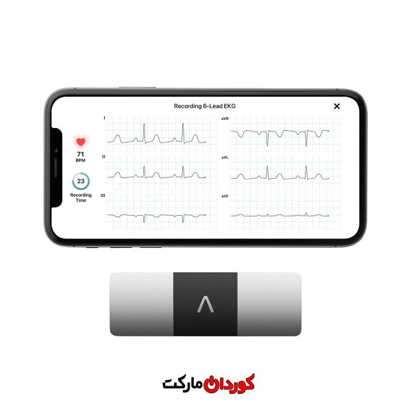 دستگاه نوار قلب قابل حمل KardiaMobile 6L برند Alive Cor مدل 6L
