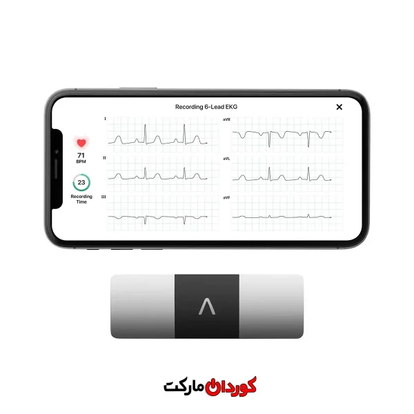 دستگاه نوار قلب قابل حمل KardiaMobile 6L برند Alive Cor مدل 6L