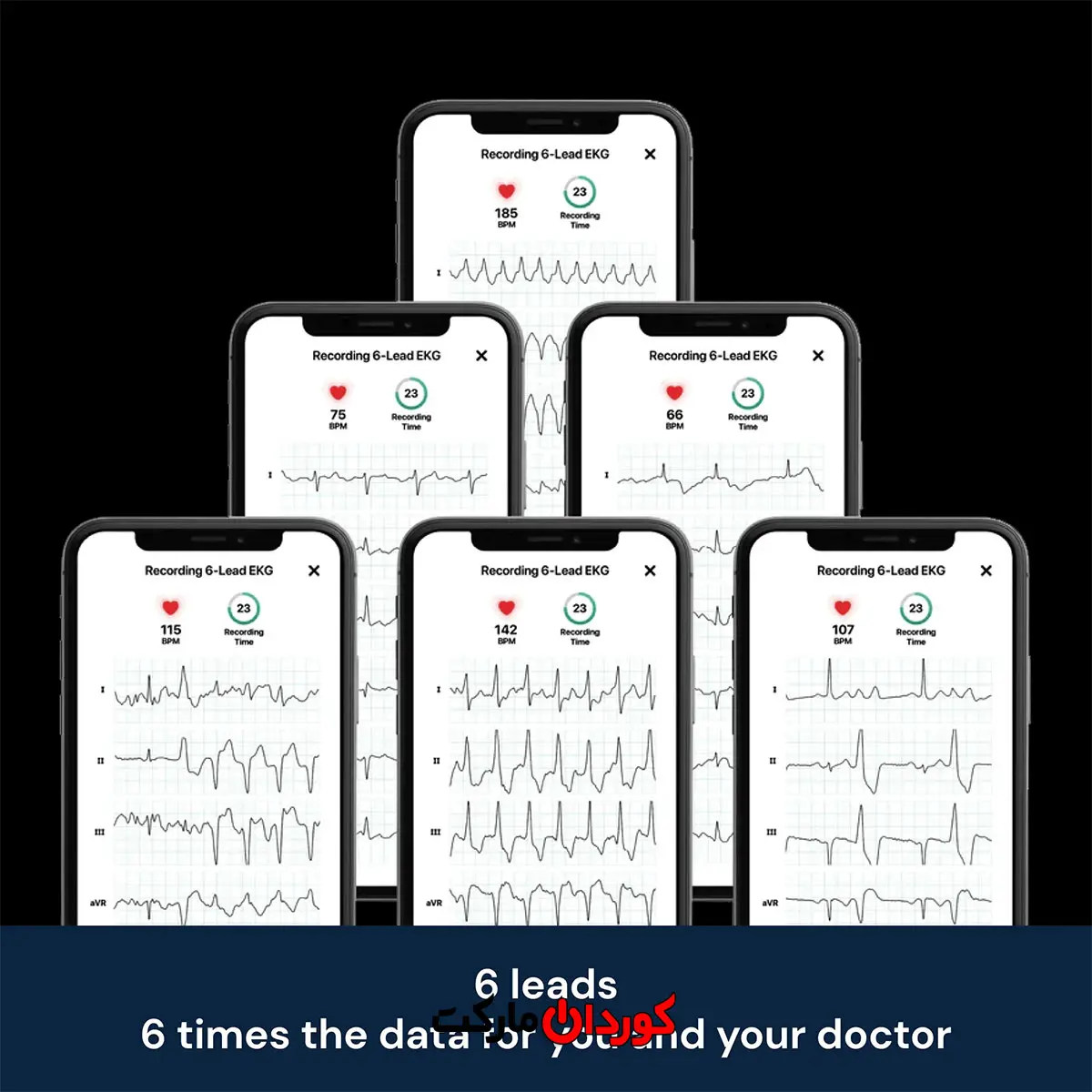دستگاه نوار قلب قابل حمل KardiaMobile 6L برند Alive Cor مدل 6L - Image 7