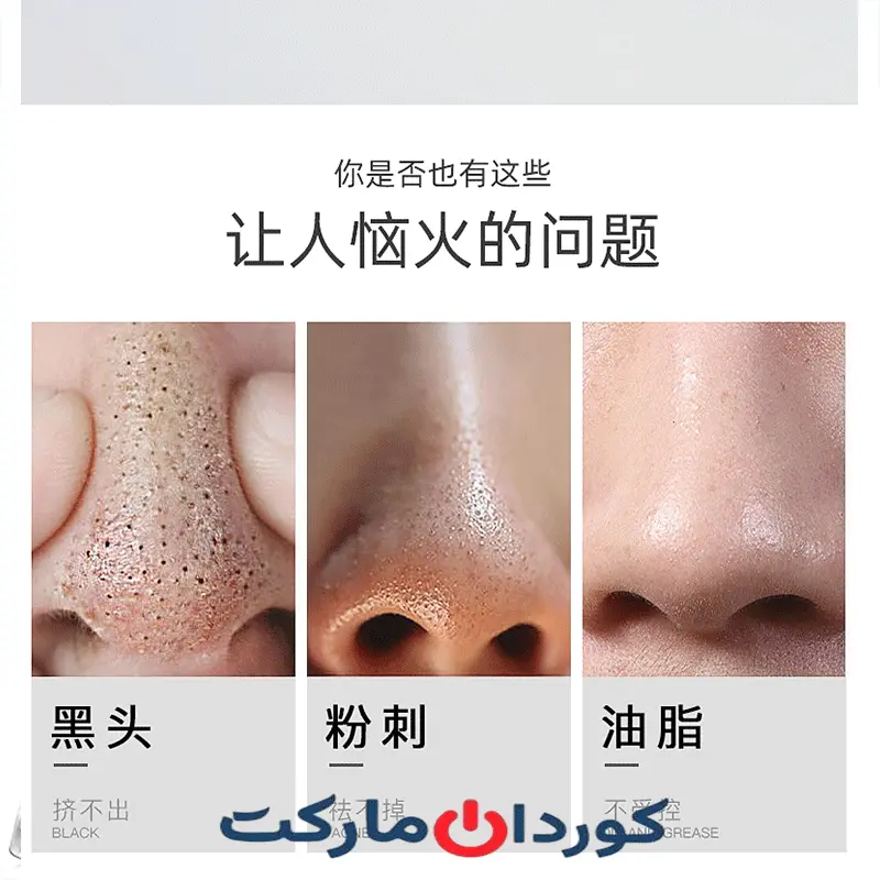 میکرودرم ( دستگاه پاک کننده جوش های سر سیاه ) مدل MP-503