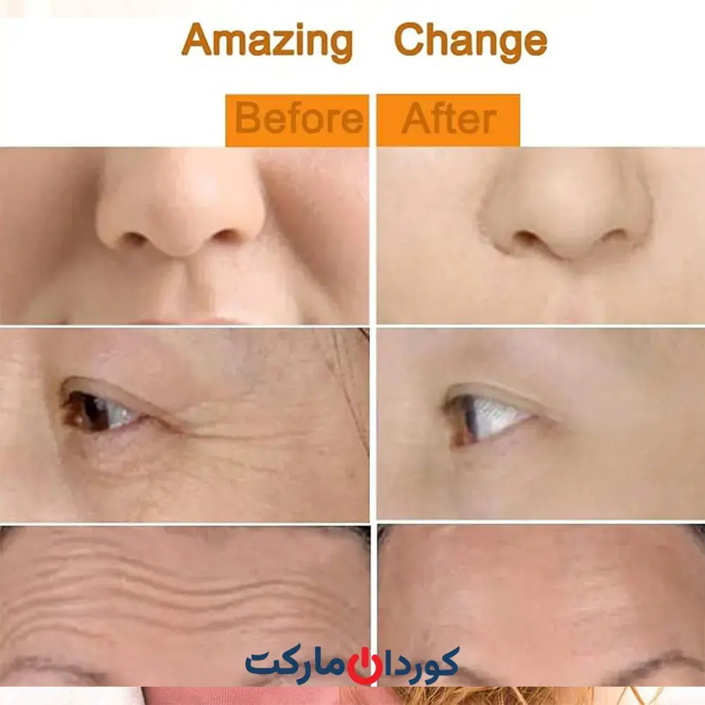ماساژور صورت برقی ویبره دار Concepta مدل 2 در 1 Energy Beauty Bar - Image 7